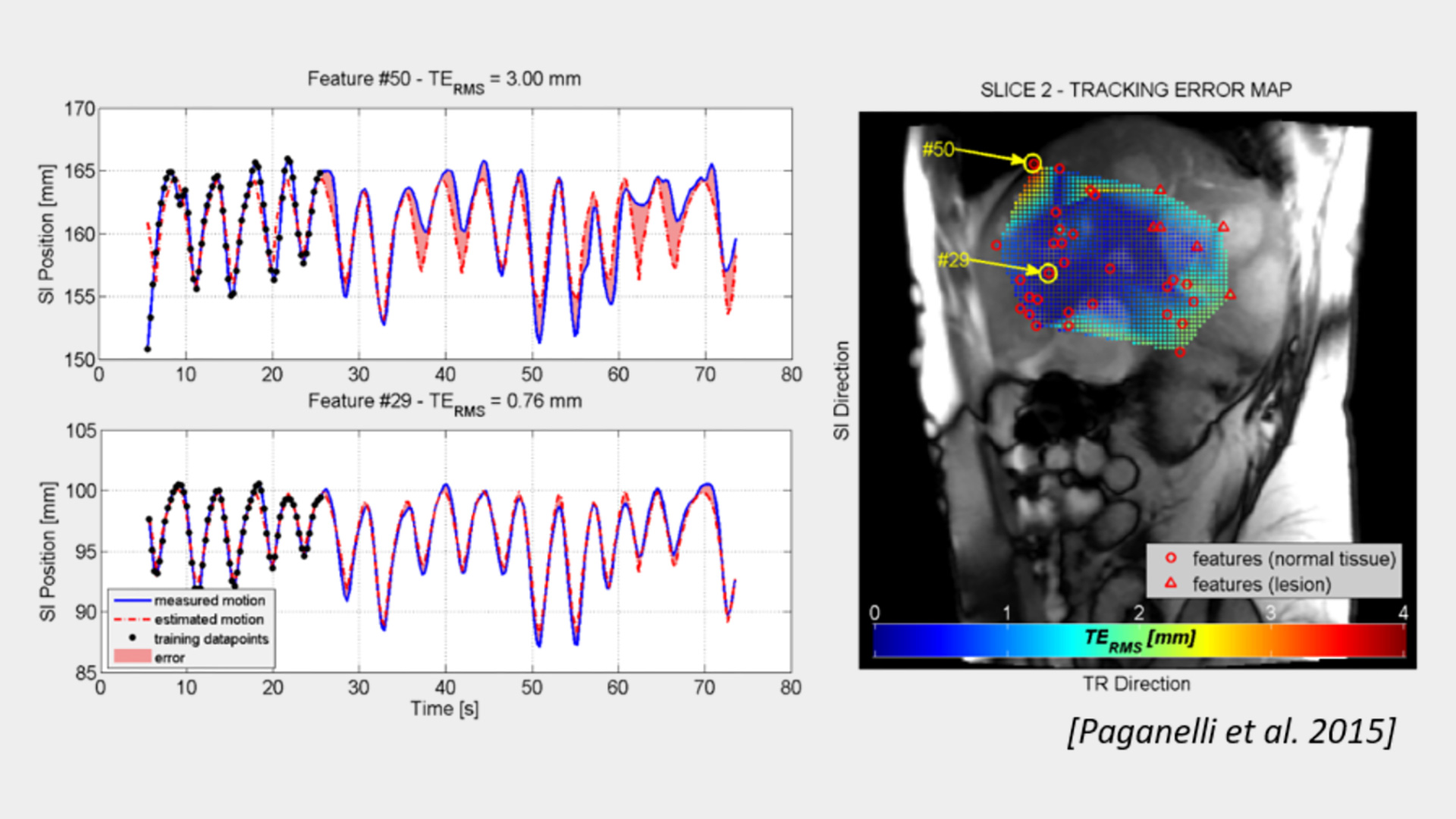 MRI Guidance